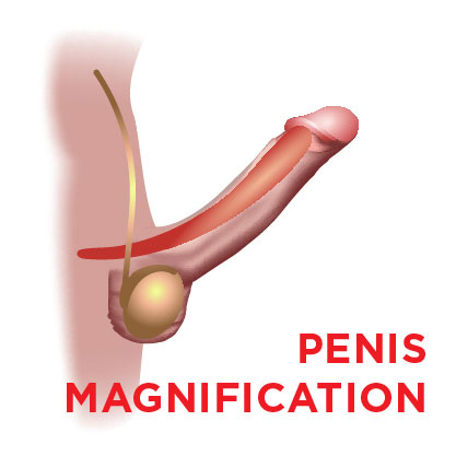 Penis Enlargement with Modus ED SWT Shock Wave Therapy